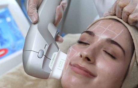 Ultraformer-Hifu non invasive lifting