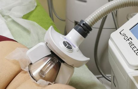 lipoFreeze cryolipolisis paphos eliana louka